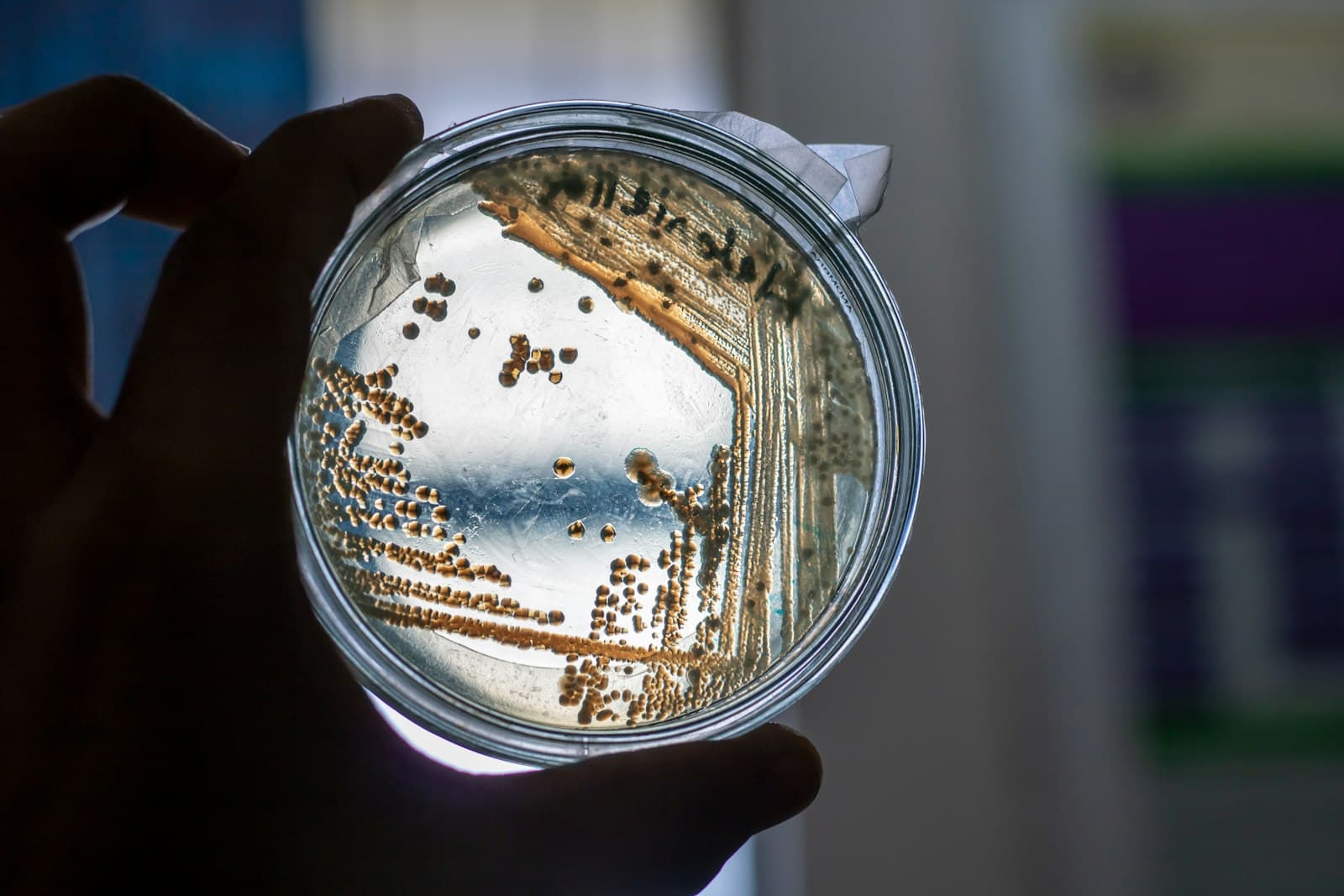 A hand holding up a petri dish with fungal colonies growing across the agar, backlit by a window